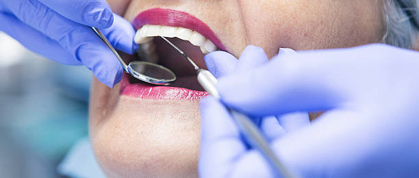 Trusted RI Emergency Dental Service Experts